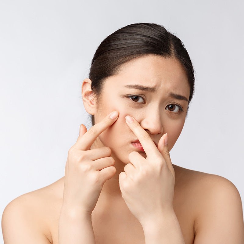 ACNE - The Fonz - Le Charme