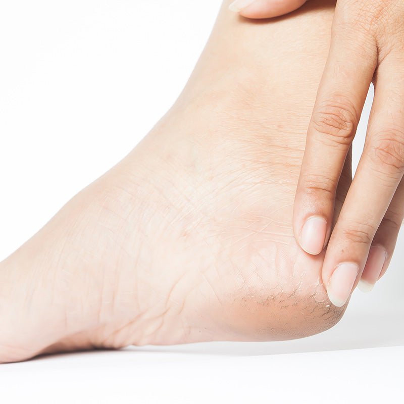 FOOT CARE - The Fonz - Le Charme