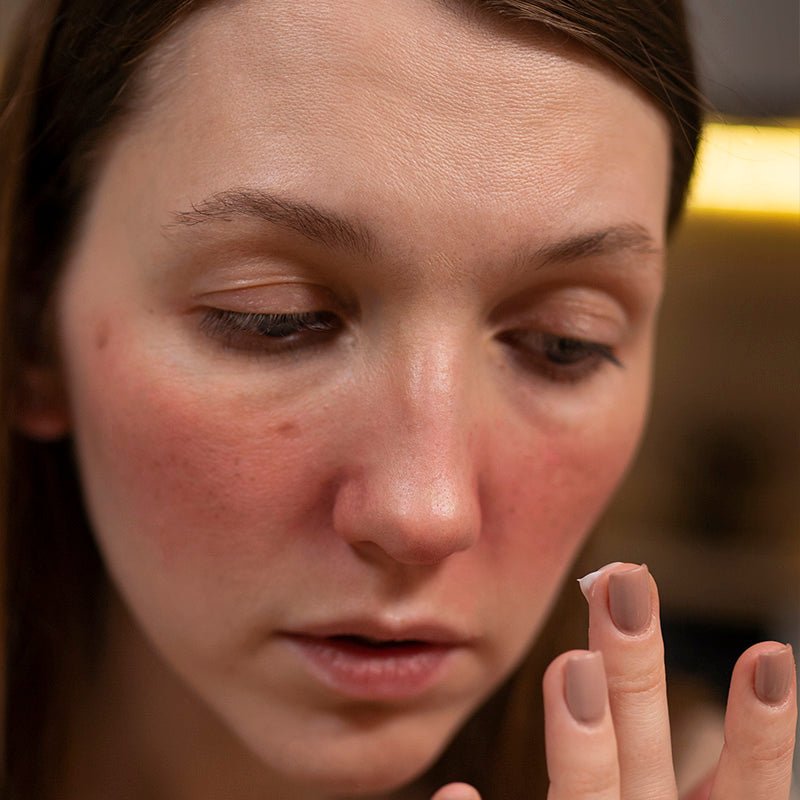 INFLAMMATION - The Fonz - Le Charme